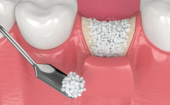 Материалы для регенерации тканей